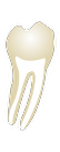 Tooth 48